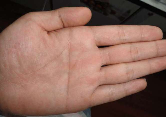 斷掌紋的男人命運(yùn)怎么樣