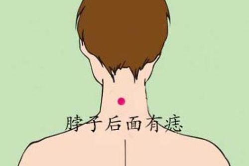 后脖上有痣的女人婚姻好嗎